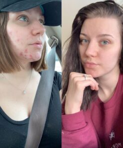 Alani Nu Balance | Supplement for Women | Hormonal Support | Weight Management and Clear Complexion | Gluten Free | Vegan | Sugar Free | 120 Veggie Capsules | 30 Day Supply Unflavored 49 7114X6TfhaL