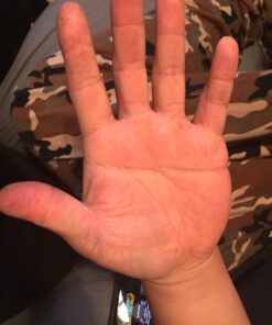 O'Keeffe's Working Hands Hand Cream, 3.4 oz., Jar, (Pack of 2) 3.4 Ounce (Pack of 2) 37 7117Bn9d5L