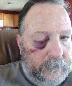 POWERTEC 71009 Push Block and Push Stick Set for Table Saws, Router Tables, Band Saws & Jointers, Dual Ergonomic Handles w/Max Grip, Hand Protection for Woodworking, Safety for Woodworkers – 5 Pack Original version 5PC Assortment 37 7119Yc1X5CL 1