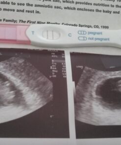 Zazzee Myo-Inositol Capsules, 2000 mg per Serving, 120 Vegan Capsules, Ideal Dosage for 40:1 Ratio, 100% Vegetarian, Hormone Balance & Healthy Ovarian Function Support, All-Natural and Non-GMO 37 711D8ctoI6L