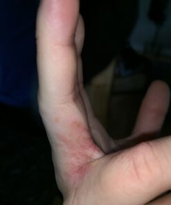 O'Keeffe's Working Hands Hand Cream, Relieves and Repairs Extremely Dry Hands, 3 oz Tube, (Pack of 2) 3 Ounce (Pack of 2) 46 711dBZoUelL