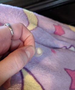 Nexcare Acne Cover, Skin Cover Absorbs Pus and Oil From Clogged Pores, Suitable Skincare for Most Skin Types - 36 Acne Covers 36 Count (Pack of 1) 42 711iaCKft9L