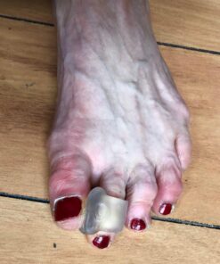 Toe Spacers for Men and Women – 4 Gel Toe Separators, Hammer Toe Straightener, Correct Toes, by 5 Stars United Big 4 Pack 43 712WeaoU L