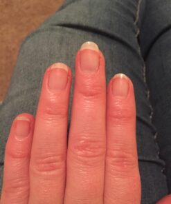 Nature Made Hair Skin and Nails with Biotin 2500 mcg, Dietary Supplement For Healthy Hair Skin and Nails Support, 120 Softgels, 120 Day Supply 120 Count 30 7131qaCzAqL