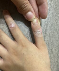 Compound W One Step Wart Remover Strips for Kids, 10 Medicated Strips for Wart Removal, 2 Pack unflavored 10 Count (Pack of 2) 41 7139IEGHTcL