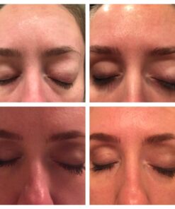 TruSkin Vitamin C Face Serum – Anti Aging Face & Eye Serum with Vitamin C, Hyaluronic Acid, Vitamin E – Brightening Serum, Dark Spot Remover, Even Skin Tone, Eye Area, Fine Lines & Wrinkles, 1 Fl Oz 1 Fl Oz (Pack of 1) 47 713WRPi0pGL