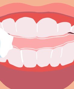 Movemints Clear Aligner Mints - Patented Aligner Seating Mints - Edible Alternative to Aligner Chewies - Xylitol Mints for Dry Mouth - Spearmint Flavor (3 Pack) 20 Count (Pack of 3) 10 713j6wqw8hL