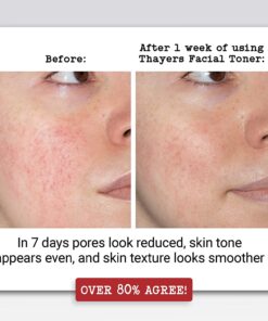 Alternative view of Thayers Rose Petal Witch Hazel with Aloe Vera - 12 oz.(2 pack) 12 Fl Oz (Pack of 2)