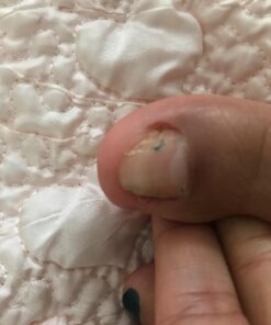 NZ Country Manuka Oil | 100% Pure Organic Essential Oil | Natural and Effective Skin Care | Plant Therapy Essential Oils for Body, Nails, Hair, Skin & Lips | 35x Stronger Than Organic Tea Tree Oil 42 7144kEZ5JrL