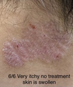 Moisturising Cream, Body and Face Moisturizer for Dry Skin, Acne Cream, 2PC 0.53 Ounce (Pack of 1) 51 714EbRf65HL