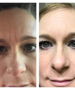 Facial Smoothies VARIETY Wrinkle Remover Strips, 160 anti wrinkle patches in 6 shapes 44 714PXC0jy9L