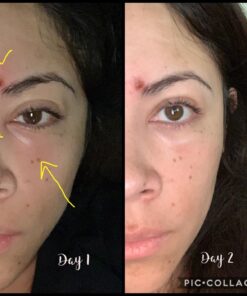 Moisturising Cream, Body and Face Moisturizer for Dry Skin, Acne Cream, 2PC 0.53 Ounce (Pack of 1) 43 714juJTR2zL