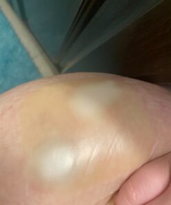 MedVance TM Hydrocolloid – Bordered Hydrocolloid Adhesive Dressing, 4"x4" Box of 5 DRESSINGS 5 Count (Pack of 1) 13 7154dTltKnL