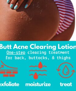 Green Heart Labs Butt Acne Clearing Lotion - Vegan & Cruelty-Free Treatment for Body, Back, Bum & Thigh - Clear Pimples, Bumps, Blackheads 4 Fl Oz (Pack of 1) 18 715FIr2ftDL 1
