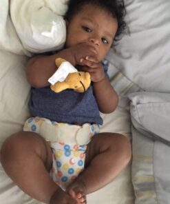 Medela Contact Nipple Shield, 24mm Medium, Nippleshield for Breastfeeding with Latch Difficulties or Flat or Inverted Nipples, Made Without BPA Standard 9 715QAOrwH2L