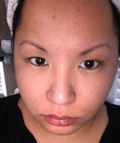 Glycolic Acid 50% Gel Peel with Chamomile and Green Tea Extracts - Professional Grade Chemical Face Peel for Acne Blemishes, Collagen Boost, Wrinkles, Fine Lines - Alpha Hydroxy Acid - 1 Bottle of 1 fl oz 38 715W6TmDvRL