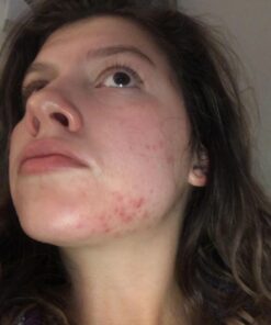 Alani Nu Balance | Supplement for Women | Hormonal Support | Weight Management and Clear Complexion | Gluten Free | Vegan | Sugar Free | 120 Veggie Capsules | 30 Day Supply Unflavored 44 715fZzUe9FL