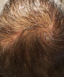 artnaturals Argan Hair Growth Shampoo - (16 Fl Oz / 473ml) - Sulfate Free - Treatment for Hair Loss, Thinning & Regrowth - Men & Women - Infused with Biotin, Argan Oil, Keratin, Caffeine 39 715i8Kj1KQL