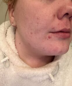 Terrasil Wound Care - 3X Faster Healing, Infection Protection Ointment for bed sores, pressure sores, diabetic wounds, ulcers, cuts, scrapes, and burns (14 gram tube) 44 716 H5gElNL