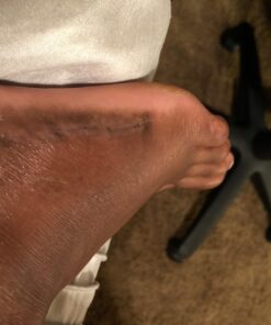 Mepitac 298400 Soft Silicone Tape, 1-1/2" x 59" 9 71680qI9MkL