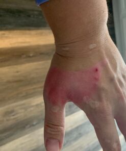 Terrasil Wound Care - 3X Faster Healing, Infection Protection for Bed sores, Pressure sores, Diabetic Wounds, Foot, Leg ulcers, cuts, scrapes, Burns - 50gm Tube 30 716CBBtM80L