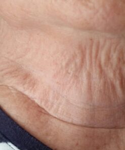 Silc Skin Collette Pad to Help with Neck & Collarbone Wrinkles from Sun, Aging, Side Sleeping, Reusable Self Adhesive Medical Grade Silicone, 1 Pad 12 7173GYIa 4L