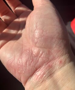 DAILY REMEDY Tea Tree Oil Extra Strength Super Balm - Athletes Foot Cream Combats Ringworm, Jock Itch, Nail Issues - Nourishes Cracked Itchy Skin on Body & Feet - Made in USA 2 Ounce (Pack of 1) 28 7173RfLnYIL 3