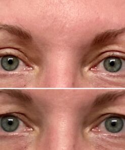 Baebody Eye Gel, Cooling Under Eye Cream For Dark Circles And Puffiness, Eye Cream Anti Aging & Hydrating, Eye Brightening Night Eye Cream 1.7 Fl Oz (Pack of 1) 54 717SFukzw7L