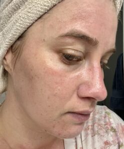 EltaMD UV Clear Face Sunscreen, SPF 46 Oil Free Sunscreen with Zinc Oxide, Protects and Calms Sensitive Skin and Acne-Prone Skin, Lightweight, Silky, Dermatologist Recommended, 1.7 oz Pump 42 717TWriZU6L