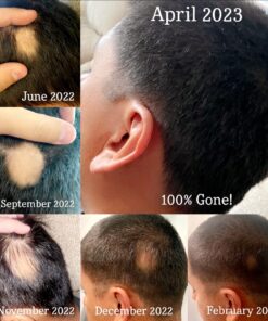 vitafusion Extra Strength Biotin Gummy Vitamins, Berry Flavored, 5,000 mcg Biotin Vitamins, America’s Number 1 Gummy Vitamin Brand, 50 Day Supply, 100 Count (Packaging may vary) 48 717XvFljxCL