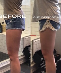 Anti Cellulite Vacuum 2 Cups Set Medical Silicone with Cellulite Massager Remover and Exfoliating Facial Brush for Perfect Body 26 717urJk8fdL