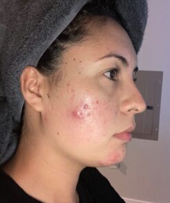 Alani Nu Balance | Supplement for Women | Hormonal Support | Weight Management and Clear Complexion | Gluten Free | Vegan | Sugar Free | 120 Veggie Capsules | 30 Day Supply Unflavored 46 718UvriNq8L