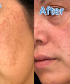 Dark Spot Corrector Face Moisturizer with SPF 30 for Even Skin Tone by L’Oreal Paris, Youth Code Anti-Aging Day Cream, Non-greasy, 1.7 oz. 1.7 Ounce (Pack of 1) 24 718faTIuWL