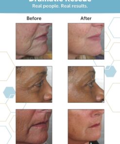 Trilane Dramatic Rescue Anti-Aging Serum with Sustainable, Olive Squalane Firms, Smooths, and Lifts for Younger Looking Skin. Cruelty-Free, 1 fl. Oz 13 718gFNV1JaL