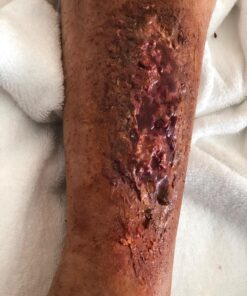 Alternative view of Smooth-On Skin Tite Ultimate Wound Kit