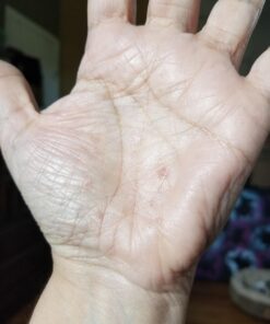 Teliaoils Lemon Balm Salve, Fast Acting/Natural Salve. Cold Sores - Skin Rashes - Irritated Skin - Itchy Skin. (1.7 Oz / 50 Ml) 1.76 Ounce (Pack of 1) 32 718wrAdPRL