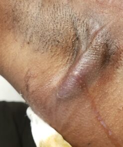 Smile's PRID Drawing Salve by Hyland's, Relief of Topical Pain and Skin Irritations, 18 grams 27 71989tcyv1L