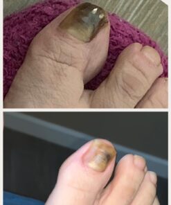 3 in 1 Professional Foot Spa Kit-with Tea Tree Foot & Body Soak-Tea Tree Body Wash & Nail Blend-Soothes Dry, Burning & Itchy Skin-Refreshes Unwanted Foot Odor-Restores Unhealthy Nails-Purely Northwest Tea Tree Oil 3 Piece Set 46 719nAAWPGML