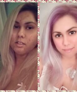 era of nature Best Raw ORGANIC AFRICAN BLACK SOAP, for Dry Skin and Skin Conditions. Pure & Natural Ingredients, Imported From Ghana - 1lb (16oz) 36 719oqEcyGsL