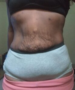 Eveline Slim Extreme 4D Liposuction Body Serum, Firming Body Lotion for Women and Men and Body Sculpting Cellulite Workout Cream 37 71A84TUt6L