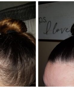 vitafusion Extra Strength Biotin Gummy Vitamins, Berry Flavored, 5,000 mcg Biotin Vitamins, America’s Number 1 Gummy Vitamin Brand, 50 Day Supply, 100 Count (Packaging may vary) 57 71A8FstX1pL