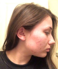 Eve Hansen Hyaluronic Acid Serum for Face (2 oz) | Hydrating Face Serum with Vitamin C + E, Wrinkle Filler, Moisturizer, and Natural Plumper | Cruelty Free, Vegan Anti Aging Serum 2 Fl Oz (Pack of 1) 48 71AD6KRZzoL