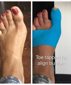 Original YogaToes - Small Sapphire Blue: Toe Stretcher & Toe Separator. Fight Bunions, Hammer Toes, Foot Pain & More! Small (Pack of 1) 36 71AK4ckDMEL 2