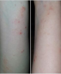 Healing Solutions 10ml Oils - Thuja Essential Oil - 0.33 Fluid Ounces 0.33 Fl Oz (Pack of 1) 28 71AL zB8AL