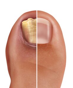 Barielle Fungus Rx 1 ounce 12 71ATgLnLCDL