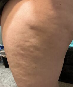 Hot Cream for Cellulite Tightening and Slimming - Invigorating Workout Cream Sweat Gel for Stomach Butt and Thighs - Sweat Cream for Belly Fat for Men and Women Body Sculpting with Essential Oils 39 71AxB3akGaL