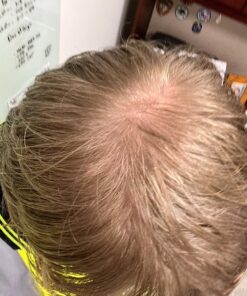 Avalon Organics Therapy Thickening Shampoo, Biotin B-Complex, 32 Oz 32 Fl Oz (Pack of 1) 39 71BJsWktWL