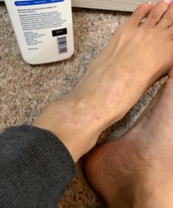 Moisturising Cream, Body and Face Moisturizer for Dry Skin, Acne Cream, 2PC 0.53 Ounce (Pack of 1) 54 71BfdlHCVL