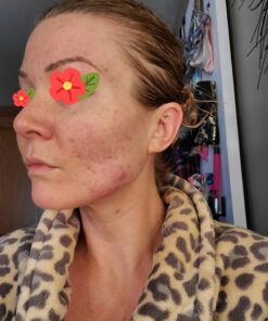 Sports Research Vitamin D3 5000 IU with Coconut MCT Oil - High Potency Vitamin D Supplement for Immune & Bone Support - Non-GMO Verified, Gluten & Soy Free – 125mcg, 360 Liquid Softgels 360 Count (Pack of 1) 37 71Bk8mLcsZL