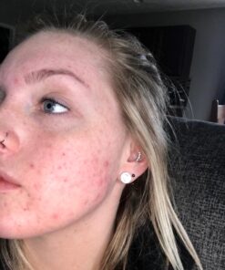 Alani Nu Balance | Supplement for Women | Hormonal Support | Weight Management and Clear Complexion | Gluten Free | Vegan | Sugar Free | 120 Veggie Capsules | 30 Day Supply Unflavored 36 71BwEMtff5L